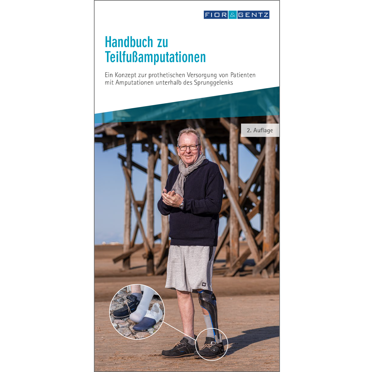 Handbuch zu Teilfußamputationen