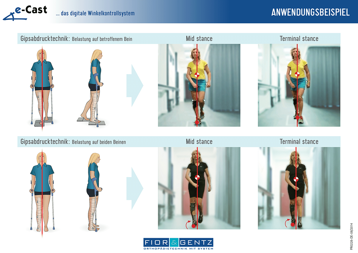 Handout e-Cast Anwendungsbeispiel Handout e-Cast Anwendungsbeispiel