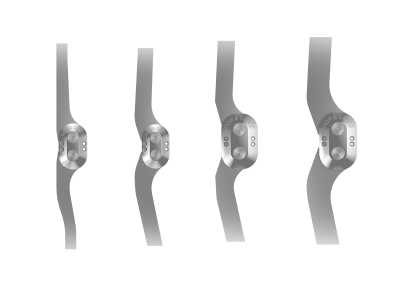 Systemgelenkschienen